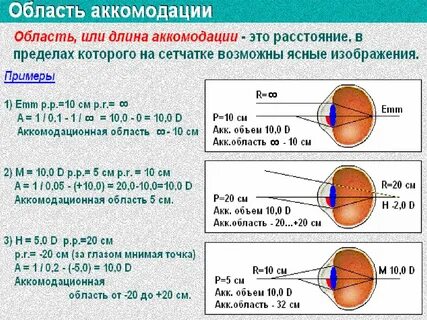 Степени миопии классификация