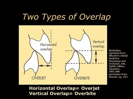 Overlap