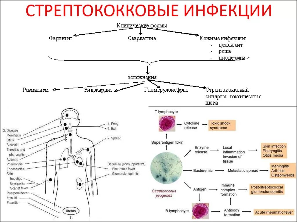 Стрептококк кожные поражения. Схема иммунного ответа на стрептококк. Механизмы передачи инфекций стрептококками. Пути заражения стрептококковой инфекцией.