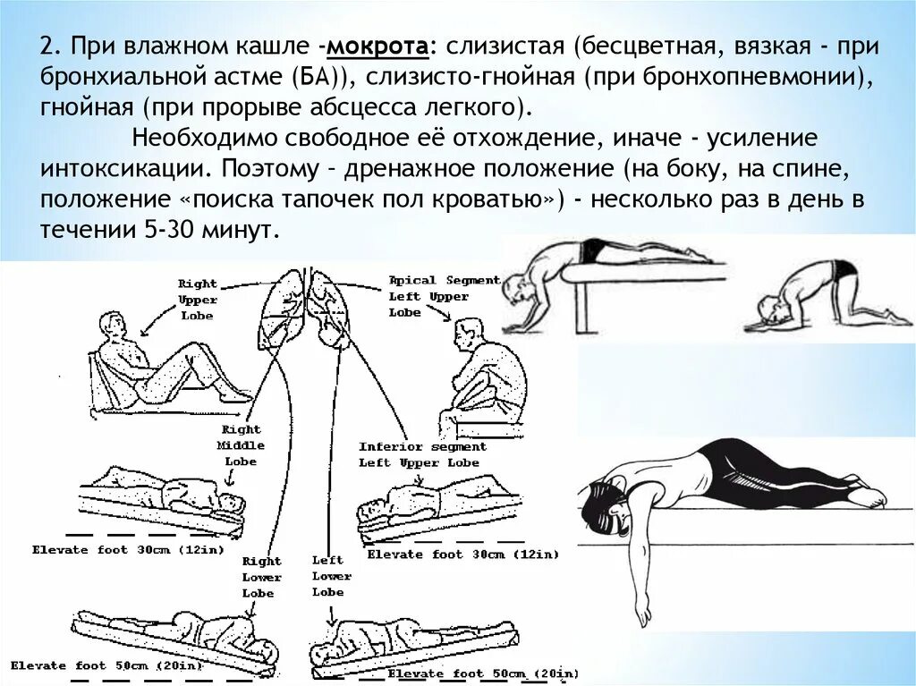 Упражнения для отхождения мокроты. Упражнения для лучшего отхождения мокроты. Упражнения для отхода мокроты. Дыхательные упражнения для вывода мокроты.