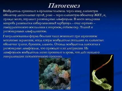 Назовите организмы возбудители