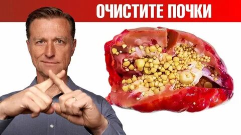 Очищение почек от оксалатов. Профилактика камней в почках ✅ в 2023 г Здоровое пи