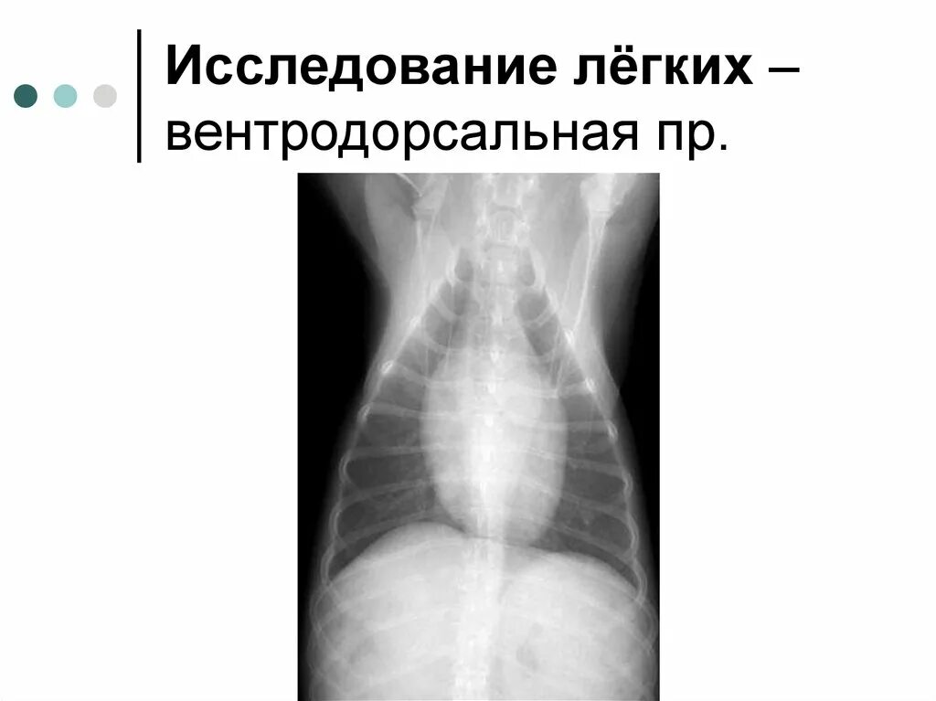 Как называется исследование легких. Исследование легких. вентродорсальная проекция. вентродорсальная проекция рентген человека.