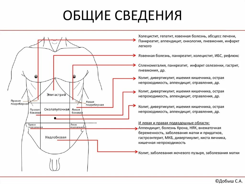 Ноет правая подвздошная область. Области живота. Подвздошная область живота. Боль в левой подвздошной области.