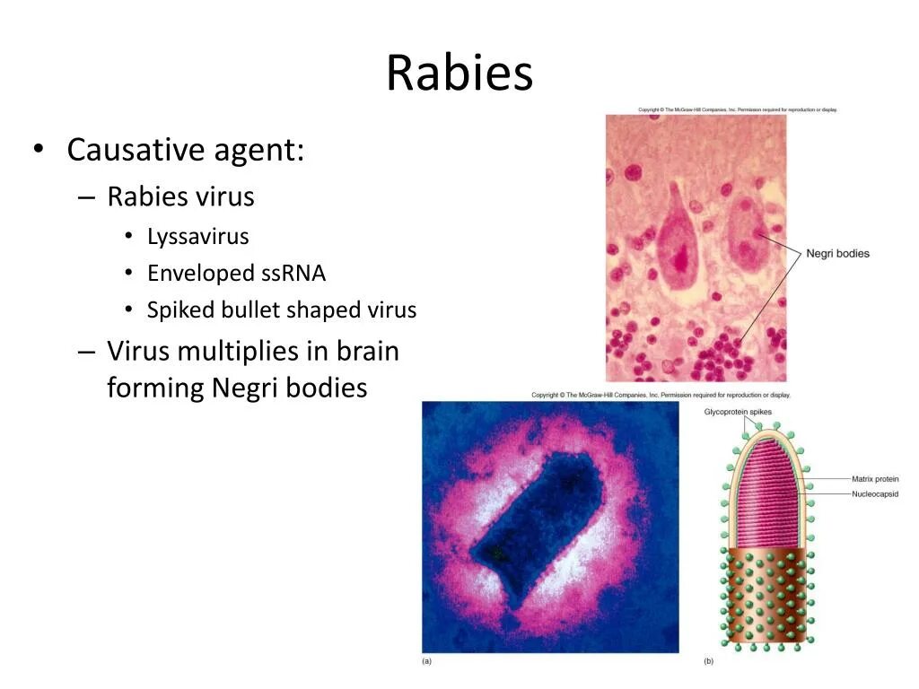 Вирус бешенства латынь. Вирус бешенства под микроскопом. rabies virus под микроскопом.