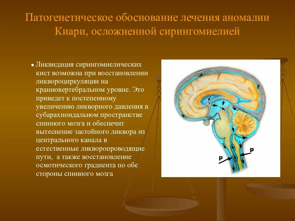 Что такое ликвор в головном мозге. Ликворная система головного мозга схема. ликворная система мозга цистерны. анатомия ликворной системы головного мозга. ликворные пространства.