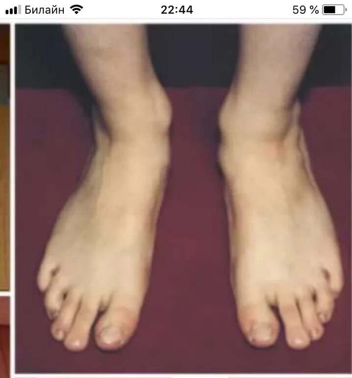 Flat Footed Изображения: просматривайте стоковые фотографии, векторные изображен