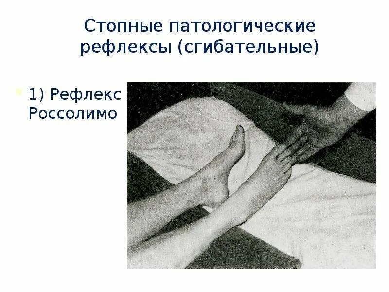 Патологические рефлек ы. Нарушение рефлексов патологические рефлексы. Патологический рефлекс бабинского. Патология рефлексов (патологические, защитные, тонические). Патологические сгибательные рефлексы россолимо.