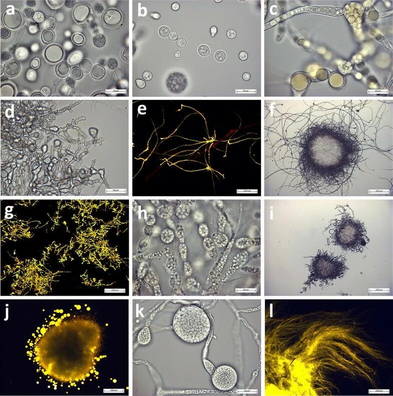 Мукор редуцент. Rhizopus микроскопия. Мукор ризопус. Мукор рацемозус. Мукор Расемосус.