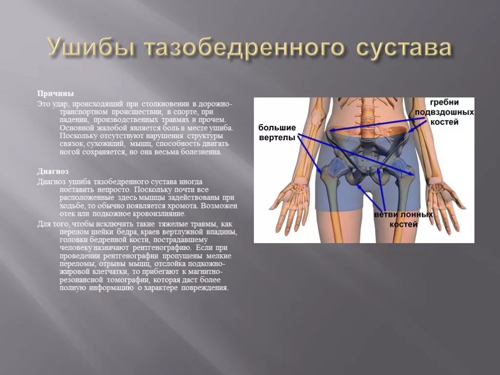 Травмы бедра и тазобедренного сустава. Гематома тазобедренного сустава. Симптомы повреждения тазобедренного сустава.