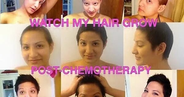 Рост волос после химиотерапии. Волосы после химиотерапии. Волосы после химиотерапии по месяцам. Волосы после химиотерапии по месяцам фото. Волосы после химиотерапии фото роста.