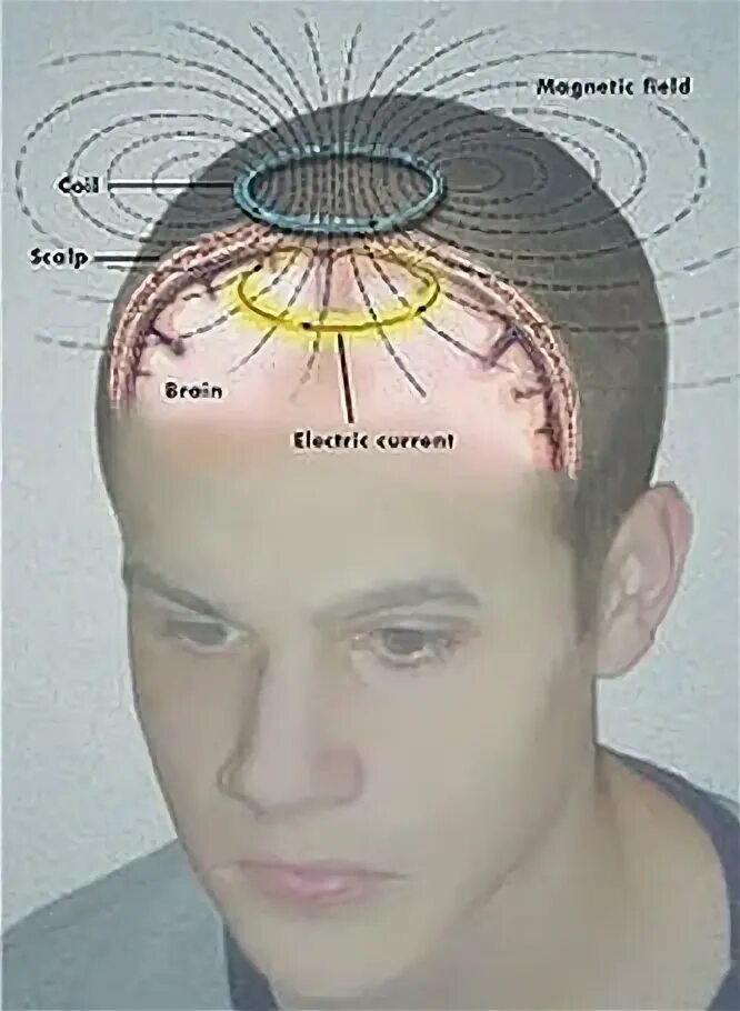 Мозг магнитное поле. Магнитное поле человека. Магнитное поле мозга. Магнитное птлечеловека. Электромагнитное поле мозга.