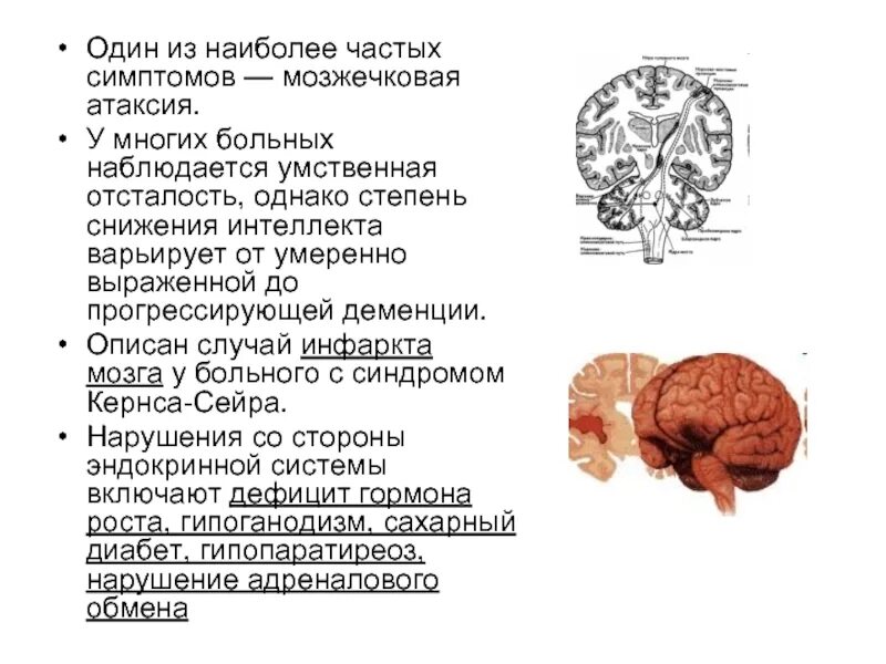 Атаксия мозга. Лобная атаксия. Вестибулярная атаксия. Спиноцеребеллярная атаксия 1 типа. Корковая атаксия.