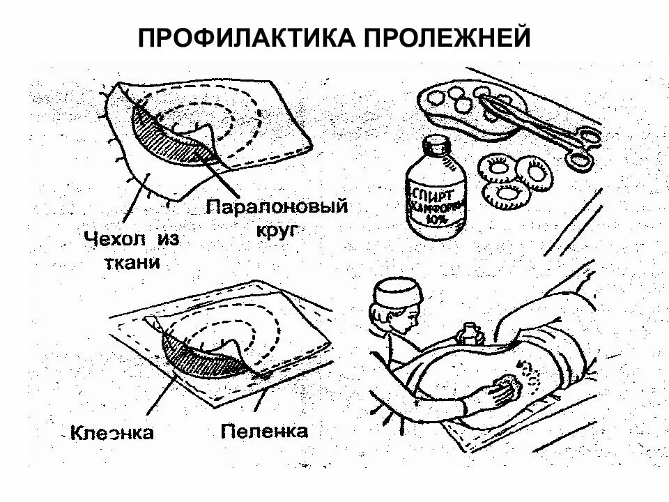 Профилактика пролежней. Пролежни профилактика пролежней. Брошюра профилактика пролежней. Профилактика пролежней схема. Профилактика пролежней алгоритм.