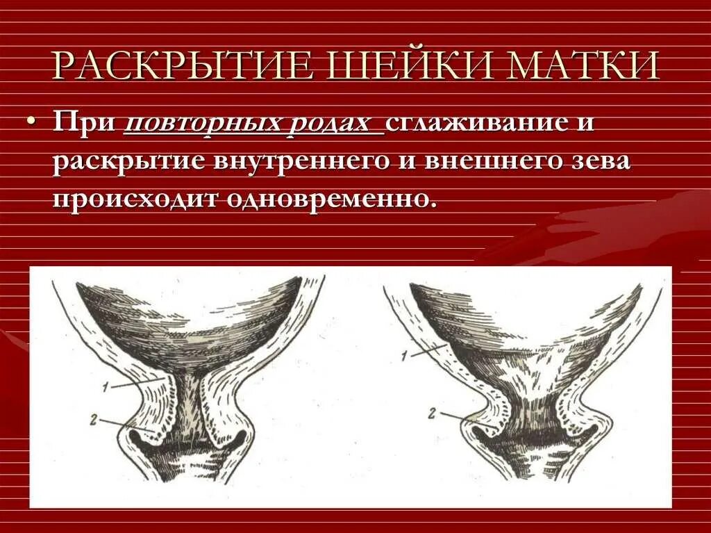 Выходит матка после родов. Раскрытая шейка матки. Наружный зев шейки матки. Раскрытие зева шейки матки.