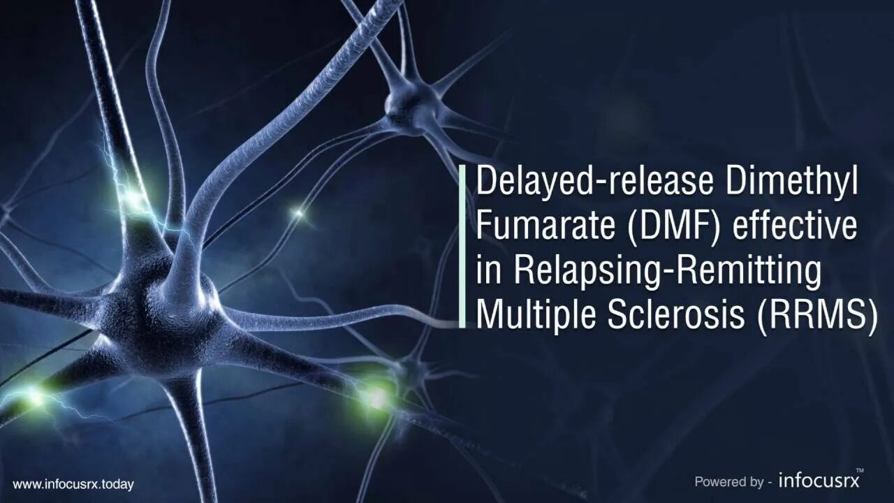 Release delay. Release delay