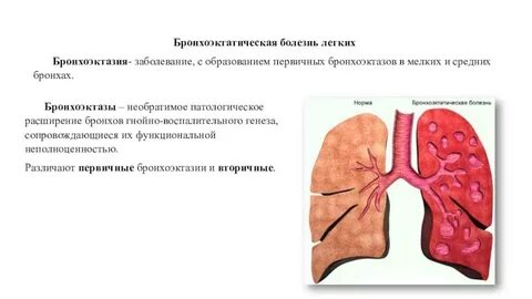 Развитие воспаления в расширенных бронхах