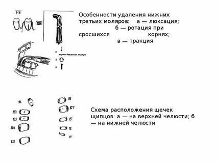 Люксация зуба