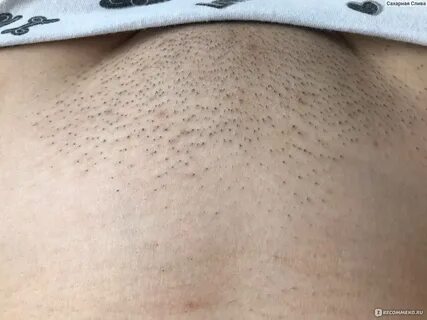 Бритье интимной зоны женская