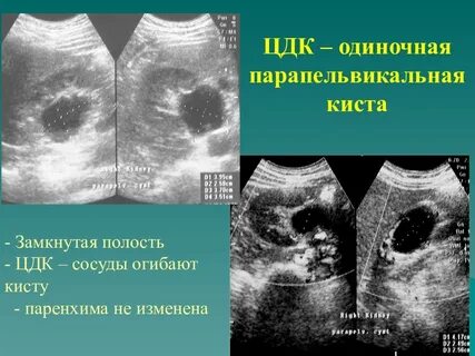 Замкнутая полость