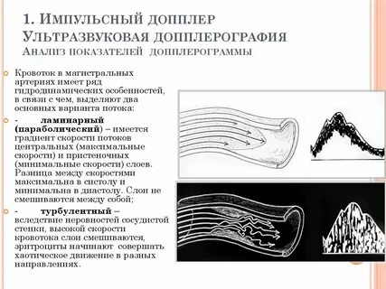 Волновой доплер