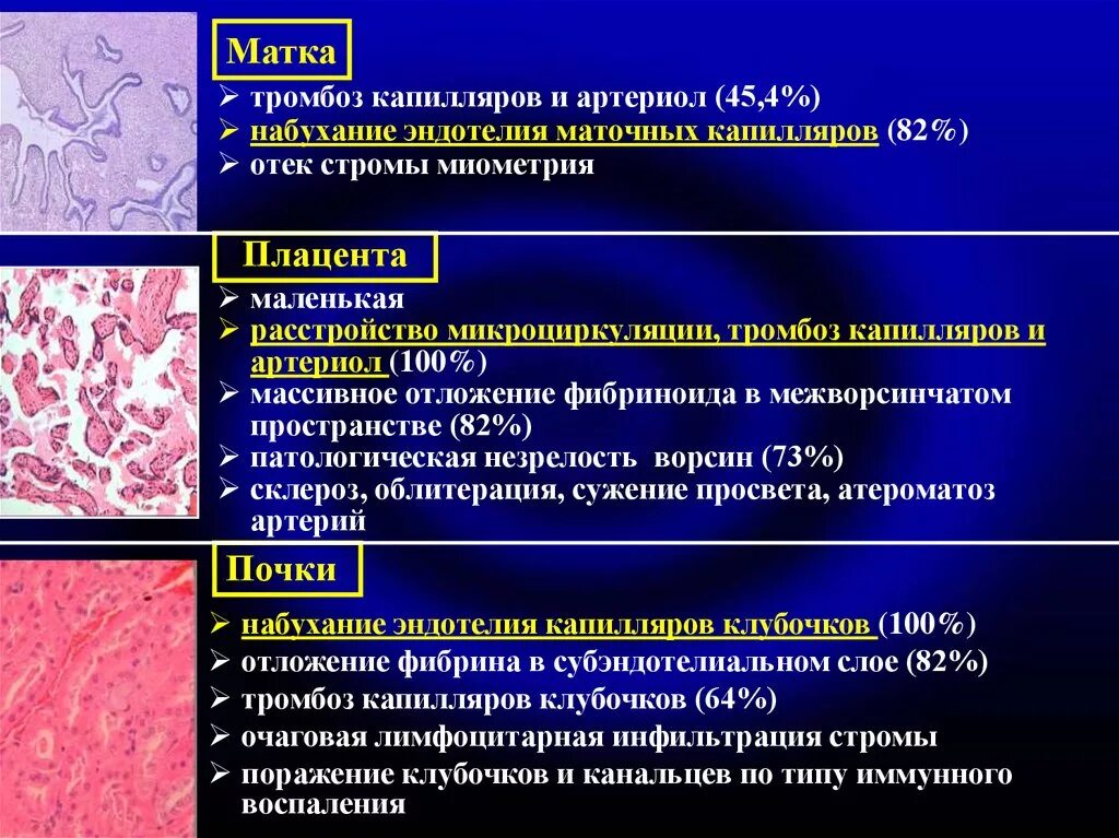 Тромб в матке
