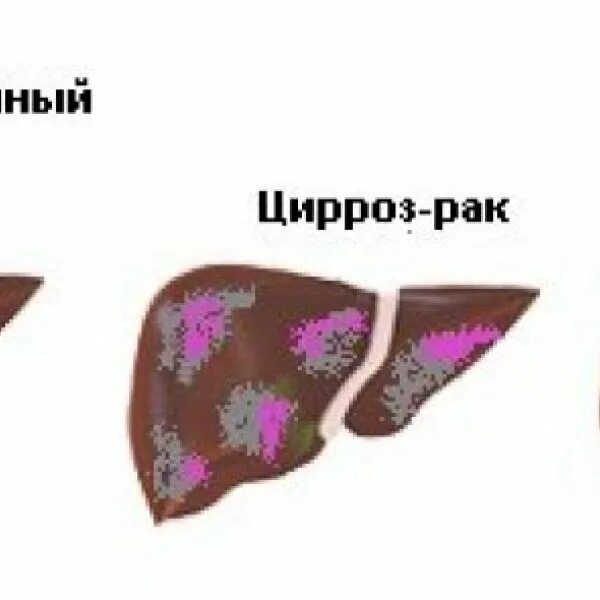 Печень симптомы котам. Новообразование в печени у собаки. Как выглядит опухоль печени.