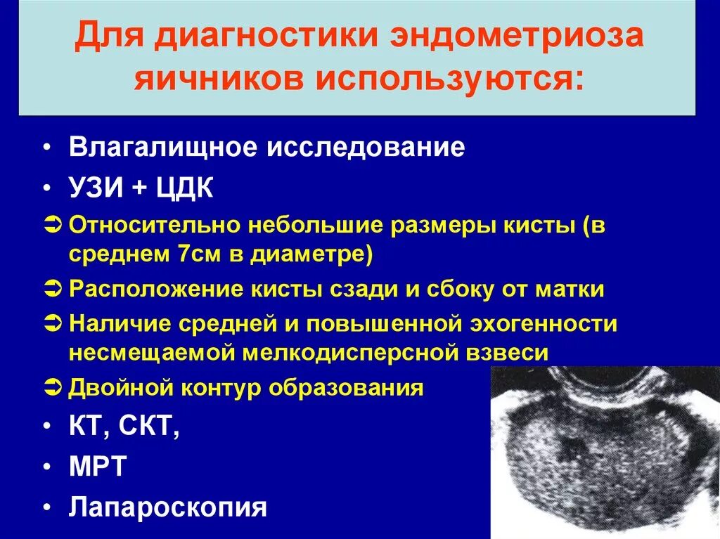 Препараты после удаления яичников. Диагноз эндометриоидная киста. Эндометриоидная киста яичника диагноз. Эндометриоз кисты яичников. Эндометриозная киста на яичнике.