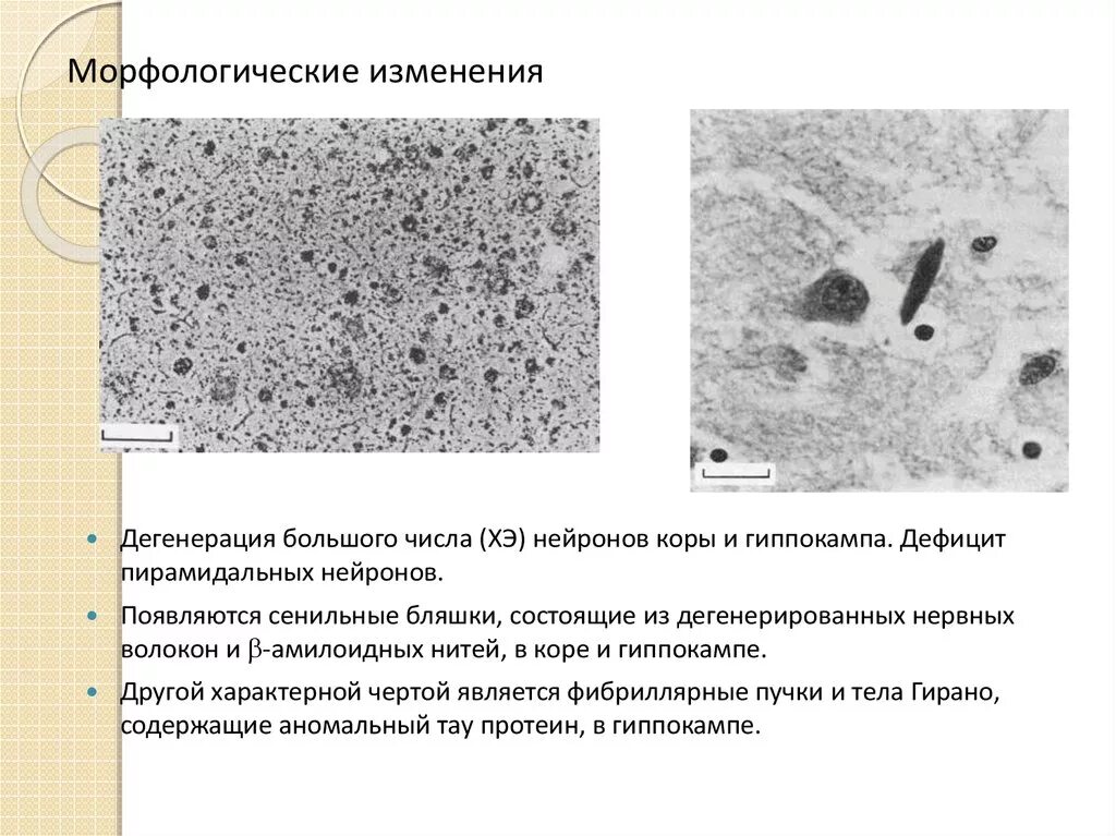 Морфологические изменения нейронов. Морфологические изменения. Морфологические изменения организма это. Морфологические изменения нейронов при клинических воздействиях.. Морфологические изменения слов