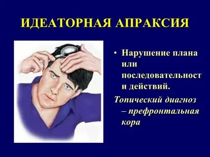Симптом липмана