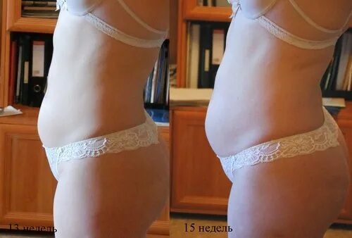 Почему перед месячными увеличивается вес и живот. Живот на 15 неделе беременности. живот при беременности 15 недель. живот у беременных по неделям у полненьких.
