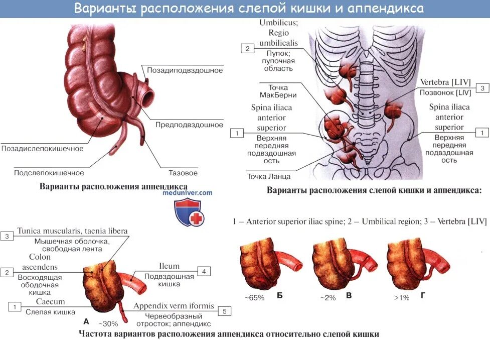 Характеристика слепой кишки. Строение слепой кишки и аппендикса. Строение червеобразного отростка. Расположение аппендикса топографическая анатомия. Слепая кишка с аппендиксом строение.