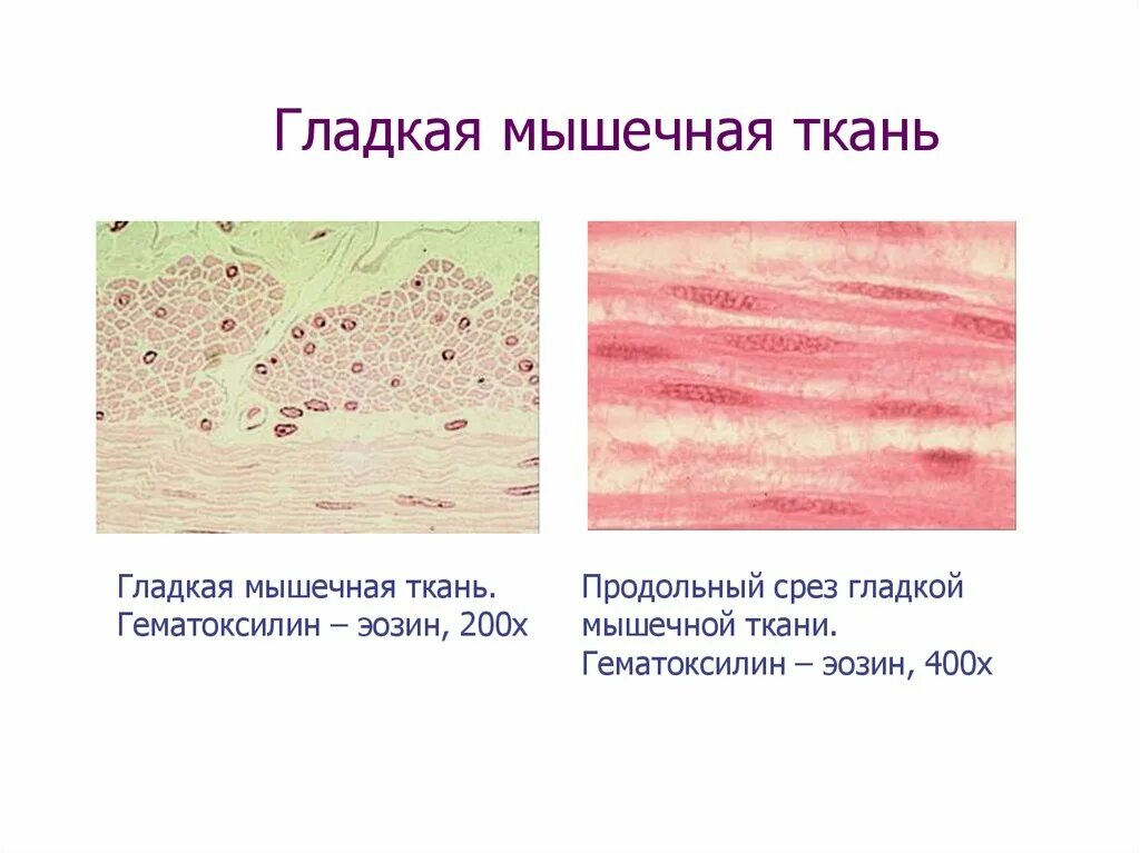 Гладкая мышечная ткань источник. Гладкая мышечная ткань микропрепарат. Продольный и поперечный срез гладкой мышечной ткани. Гладкая мышечная ткань мочевого пузыря. Гладкая мышечная ткань гематоксилин эозин.