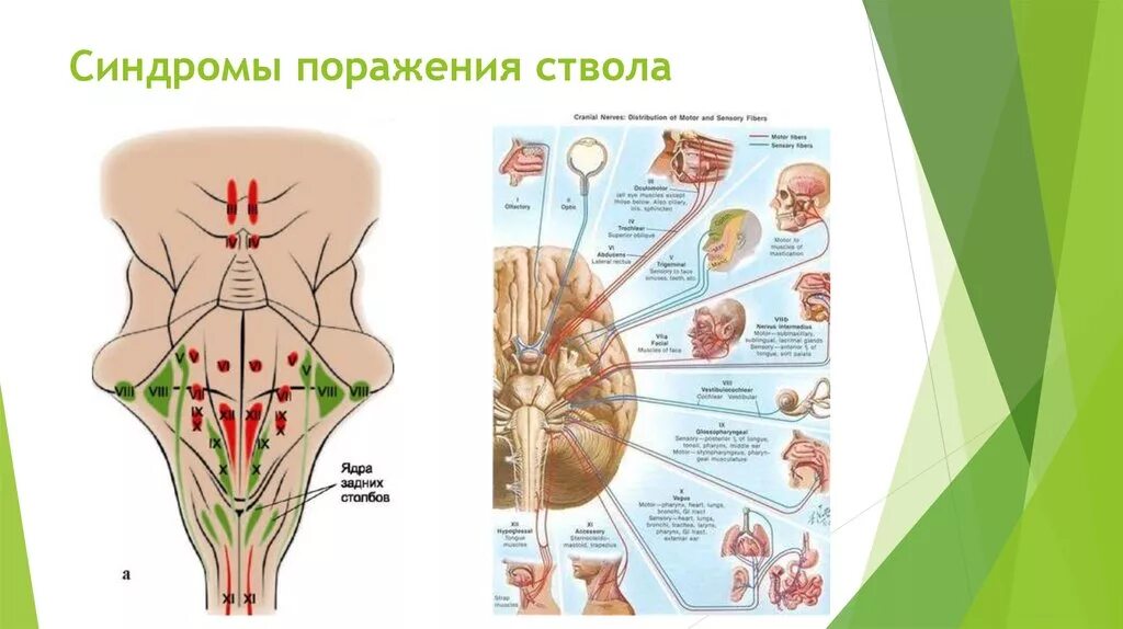 Поражение ствола головного. Поражение ствола головного мозга альтернирующие синдромы. Синдром поражения ствола головного мозга альтернирующие синдромы. Симптомы поражения ствола головного мозга неврология. Альтернирующие синдромы при поражении ствола.