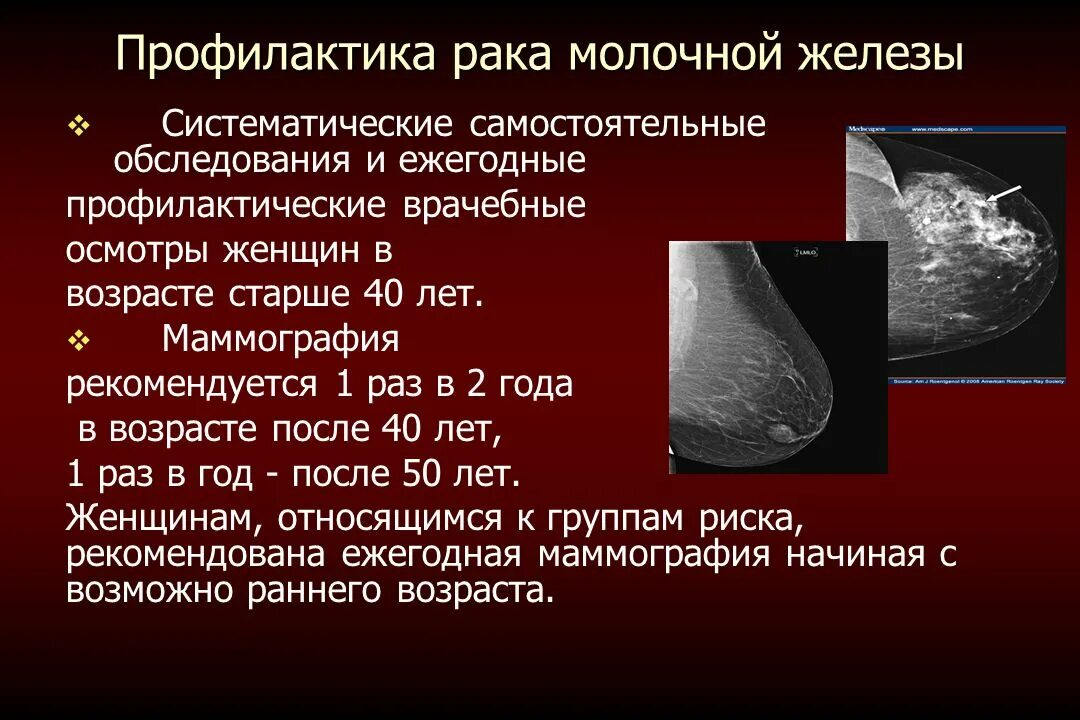 Молочной железы у мужчин симптомы. Злокачественное новообразование молочной железы. Злокачественные заболевания молочных желез. Доброкачественные новообразования молочной железы. Злокачественные образования молочной железы.