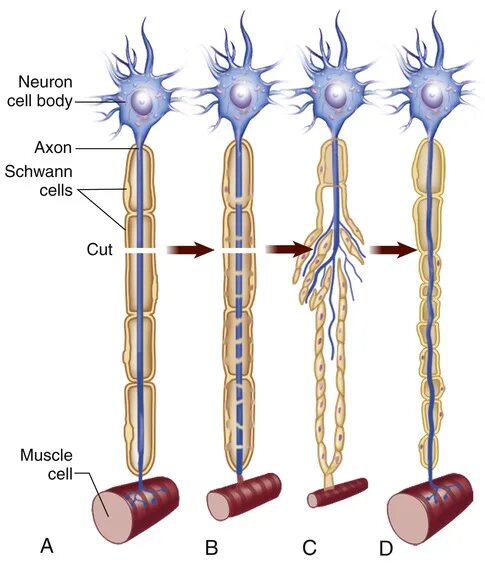 Регенерация нервных волокон гистология. Дегенерация нервных волокон гистология. Дегенерация периферического нервного волокна.. Регенерация нервных волокон после повреждения.