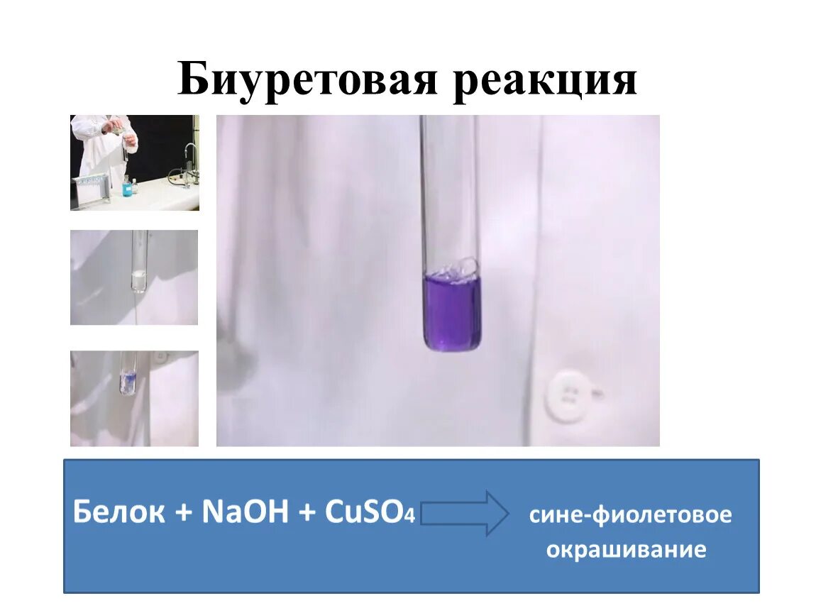 Глицин и гидроксид меди 2 реакция. Реакция Пиотровского биуретовая реакция. Белок cuso4 NAOH биуретовая реакция. Биуретовая реакция с NAOH. Положительная биуретовая реакция.