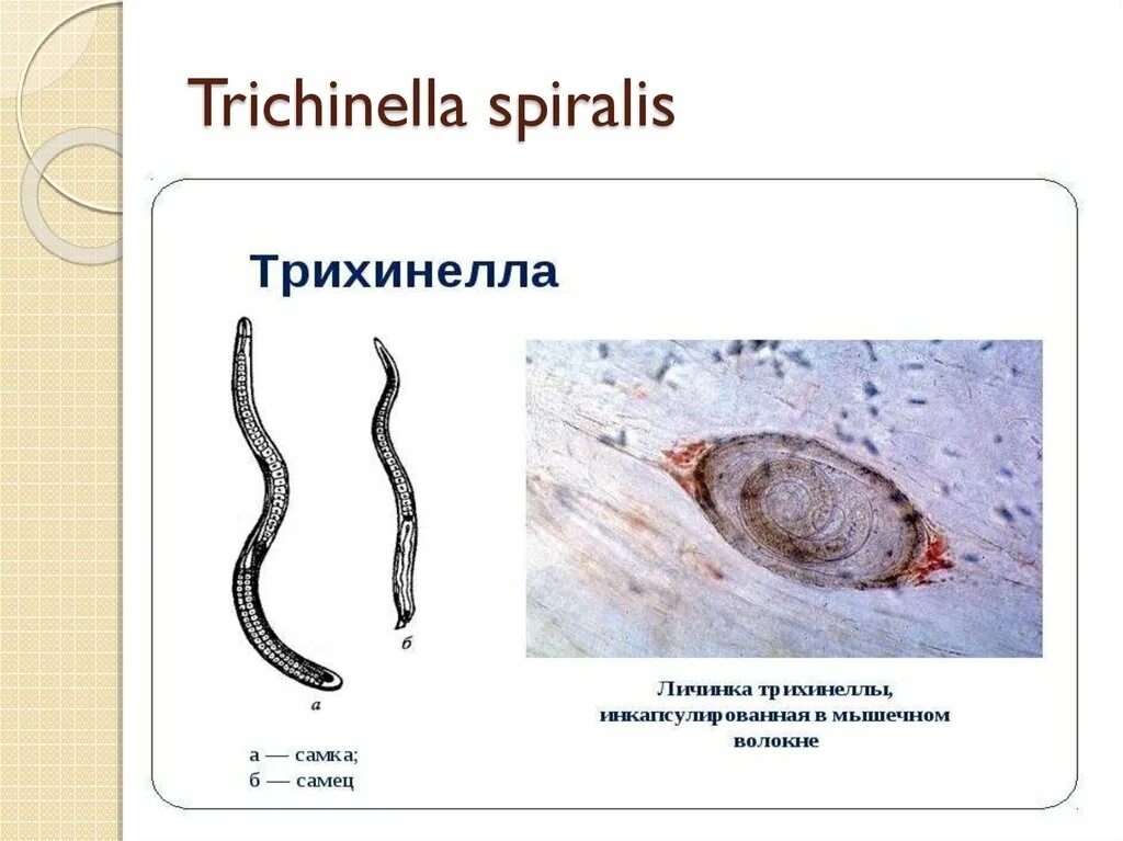 Трихинелла спиральная - Trichinella spiralis. Трихинелла Спиралис личинки. Трихинелла Спиралис яйцо.