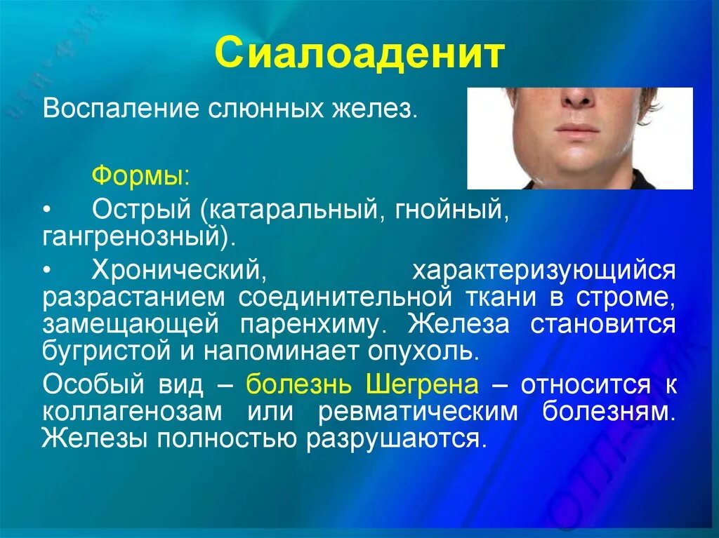 Описание гнойного. Воспаление слюнных желез. Воспаление слюнной железы.