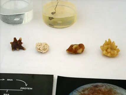 What Is The Most Common Type Of Kidney Stone Crystal Outlet cartridgemaniakenya.