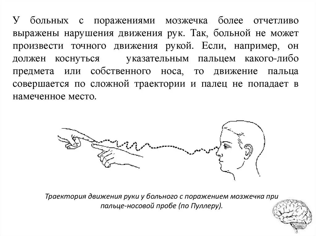 Пальценосовая проба при поражении мозжечка. Проведение пальце носовой пробы алгоритм. Проба дотронуться пальцем до кончика носа. Пробы для исследования мозжечка. Тест мозжечок