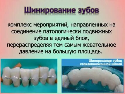 Шинирование