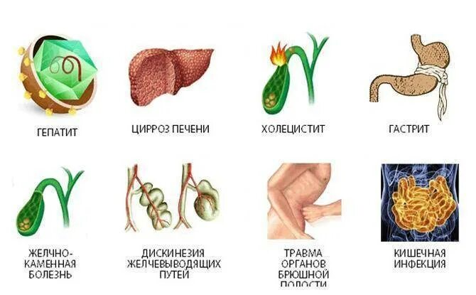 Диффузно реактивные изменения поджелудочной железы. Реактивные изменения поджелудочной железы. реактивные изменения поджелудочной железы у ребенка. реактивные изменения поджелудочной железы на узи. эхопризнаки реактивных изменений поджелудочной железы.