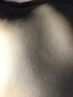 Бугорок вода