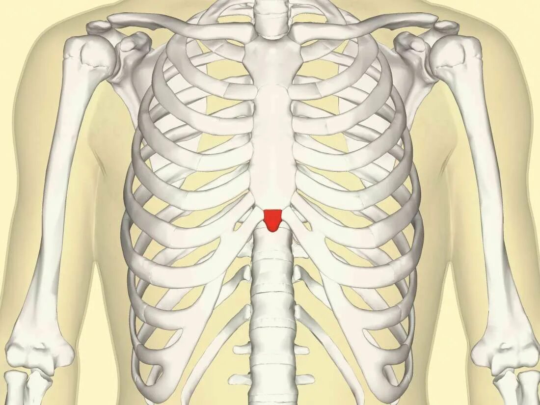 Мечевидный отросток грудины. Xiphoid process of the sternum. Robicsek procedure sternum. Osteopat-Babkin/sternum. Dull Pain left Side between Ribs and Hip.