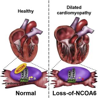 Perturbation of NCOA6 Leads to Dilated Cardiomyopathy: Cell Reports.