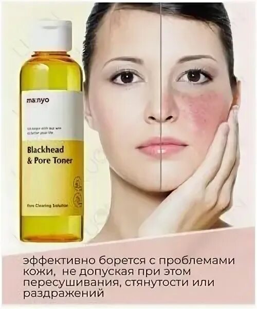 Blackhead and Pore Toner 210ml. Тонер Manyo Pore. Manyo Black head &Pore Toner. Тоник против черных точек с BHA-кислотой Manyo Blackhead & Pore Toner. Manyo blackhead pore