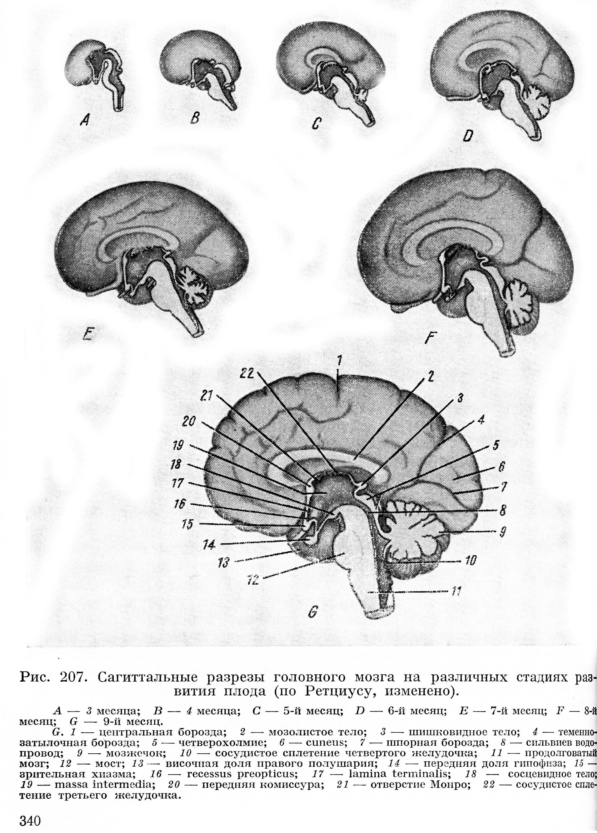 Внутриутробное развитие мозга. Схему развития головного мозга человека. Изобразите схему развития головного мозга человека. Схема развития головного мозга человека фронтальный и Сагиттальный. Онтогенез головного мозга схема.