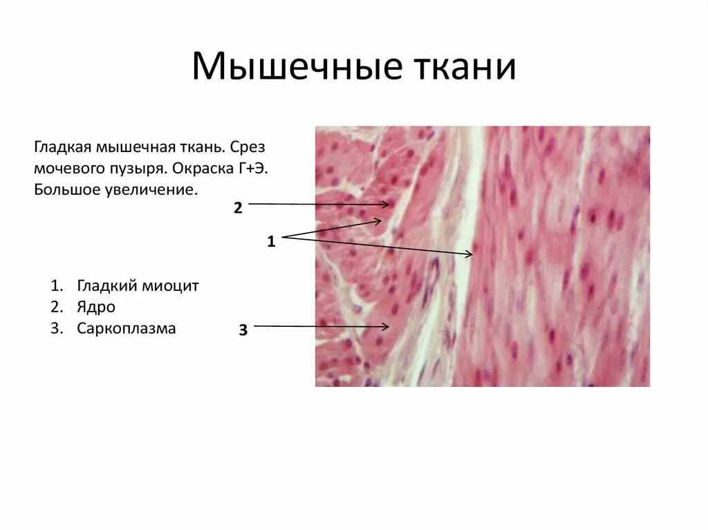 Скелетная мышечная ткань гистология. Поперечнополосатая мышца гистология. Гладкая мышечная ткань на препаратах Гиста. Гладкая мышечная ткань мочевого пузыря препарат.