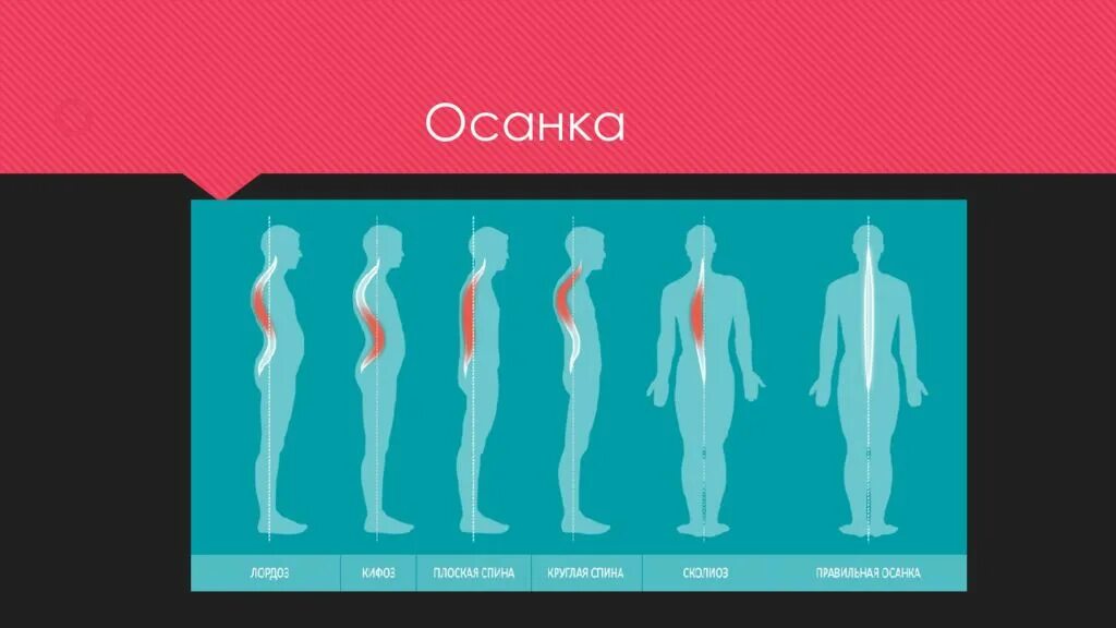 Осанка влияет на вес. Тяжелый портфель влияет на осанку. Осанка влияет на вес. Влияние портфеля на осанку школьника. Осанка влияет на вес.